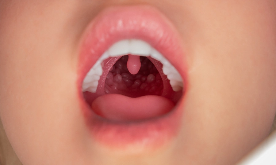 FANREAL リアル口腔インタラクション体験