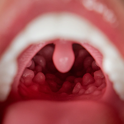 FANREAL リアル口腔インタラクション体験