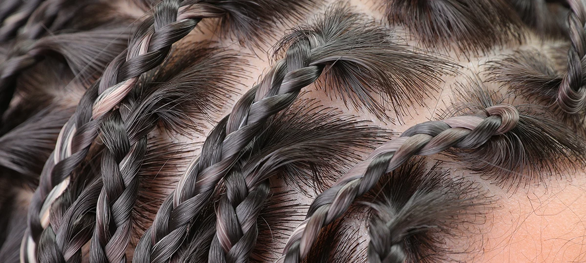 交換可能なウィッグから恒久植毛スタイルまで