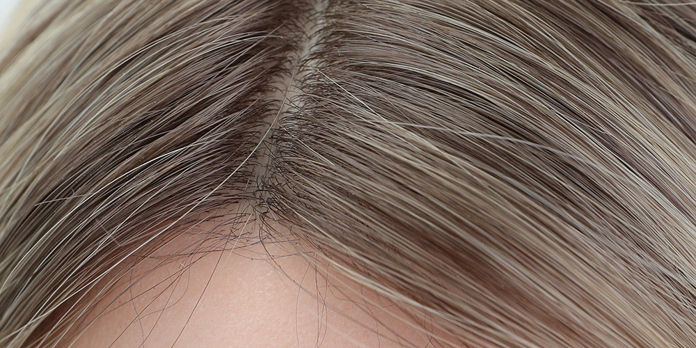 植毛とウィッグ、どちらを選ぶべき？